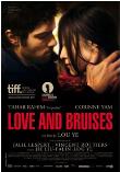 LOVE AND BRUISES